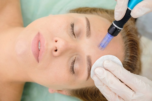 MICRO NEEDLING